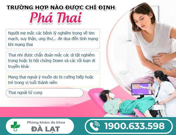 Hình ảnh minh họa